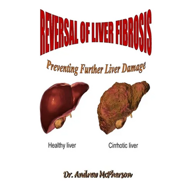 Reversal of Liver Fibrosis: Preventing Further Liver Damage
