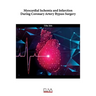 Myocardial Ischemia and Infarction During Coronary Artery Bypass Surgery