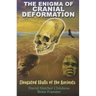 The Enigma of Cranial Deformation: Elongated Skulls of the Ancients