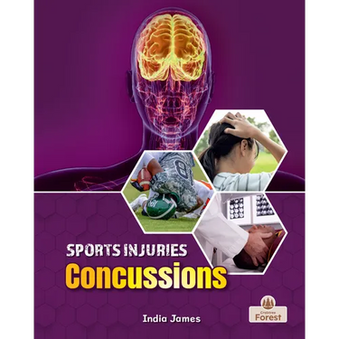Concussions