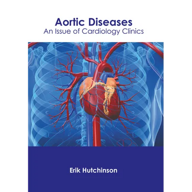 Aortic Diseases: An Issue of Cardiology Clinics