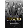The Graft: How a Pioneering Operation Sparked the Modern Age of Organ Transplants
