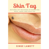 Skin Tag: Natural DIY Methods of removing Mole, Wart and Skin Tag