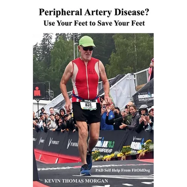Peripheral Artery Disease? Use Your Feet to Save Your Feet: PAD Self Help From FitOldDog
