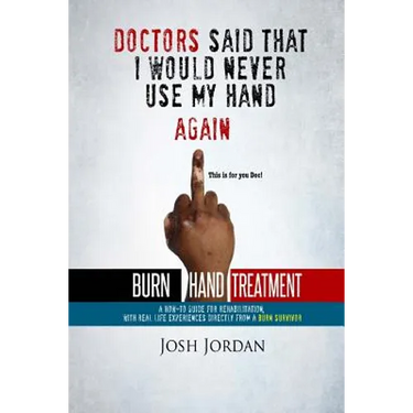 Burn Hand Treatment: A How-To Guide for Rehabilitation with Real Life Experiences from a Burn Survivor
