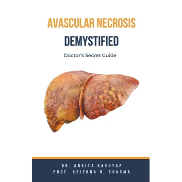 Avascular Necrosis Demystified: Doctor's Secret Guide