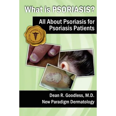 What is Psoriasis?: All About Psoriasis for Psoriasis Patients