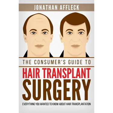 The Consumer's Guide to Hair Transplant Surgery: Everything You Wanted to Know About Hair Transplantation