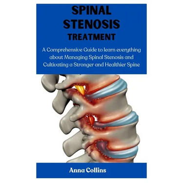 Spinal Stenosis Treatment: A Comprehensive Guide to learn everything about Managing Spinal Stenosis and Cultivating a Stronger and Healthier Spin