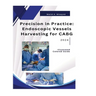 Precision in Practice: Endoscopic Vessel Harvesting for CABG