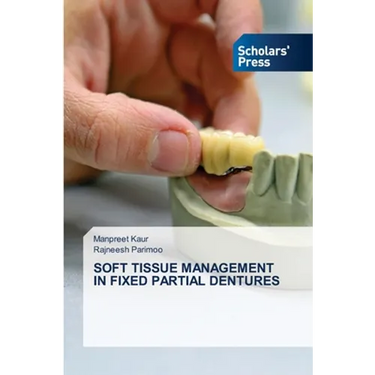 Soft Tissue Management in Fixed Partial Dentures