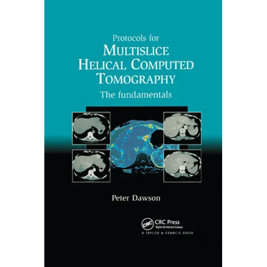 Protocols for Multislice Helical Computed Tomography: The Fundamentals