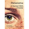 Melanoma: It Started With a Freckle