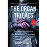 The Organ Thieves: The Shocking Story of the First Heart Transplant in the Segregated South