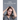Help! I'm Losing My Hair: Hair Loss - You Can Treat It
