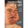 Embracing My Scars: A journey of hope in the face of adversity