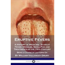 Eruptive Fevers: A History of Medicine - Scarlet Fever, Measles, Small-Pox and Treatments in the 19th Century - Being a Course of Lectures On