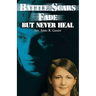 Battle Scars Fade, But Never Heal