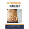 Lichen Planus Demystified Doctors Secret Guide