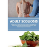 Adult Scoliosis: A Beginner's 2-Week Quick Start Guide on Managing Adult Scoliosis Through Diet and Other Natural Methods, With Sample Recipes and a M