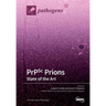PrPSc Prions: State of the Art