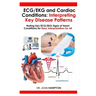 ECG/EKG and Cardiac Conditions: Interpreting Key Disease Patterns: Noting Key ECG/EKG Signs of Heart Conditions for Easy Interpretation for All
