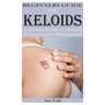 Beginners Guide on Keloids