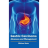 Gastric Carcinoma: Advances and Management