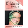 When Blushing Hurts: Overcoming Abnormal Facial Blushing