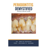 Periodontitis Demystified: Doctor's Secret Guide