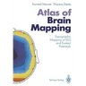 Atlas of Brain Mapping: Topographic Mapping of Eeg and Evoked Potentials