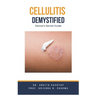Cellulitis Demystified: Doctor's Secret Guide