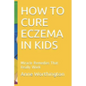 How to Cure Eczema in Kids: Miracle Remedies That Really Work