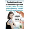 Tendonitis and the Different Types of Tendonitis Explained. Tendonitis Symptoms, Diagnosis, Treatment Options, Stretches and Exercises All Included.