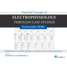 Essential Concepts of Electrophysiology Through Case Studies: Intracardiac EGMs: Intracardiac EGMs