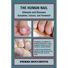 THE HUMAN NAIL - Ailments and Diseases: Symptoms, Causes, and Treatment