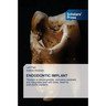 Endodontic Implant