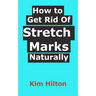 How to Get Rid Of Stretch Marks Naturally