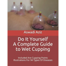 Do It Yourself - a Complete Guide to Wet Cupping: Included Are Cupping Points Illustrations For 94 Types Of Diseases