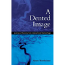A Dented Image: Journeys of Recovery from Subarachnoid Haemorrhage