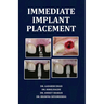 Immediate Implant Placement