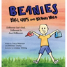 Beanies, Ball Caps, and Being Bald: Different Isn't Bad, Different Is Just Different