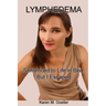 Lymphedema: Sentenced to Life in Bed, But I Escaped