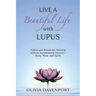 Live a Beautiful Life with Lupus: Habits and Rituals for Thriving with an Autoimmune Disease--Body, Mind, and Spirit