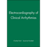 Electrocardiography of Clinical Arrhythmias