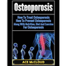 Osteoporosis: How To Treat Osteoporosis: How To Prevent Osteoporosis: Along With Nutrition, Diet And Exercise For Osteoporosis