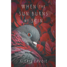 When the Sun Burns My Skin