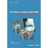The Tibial Plateau Fractures: Diagnosis and Treatmment