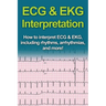 ECG & EKG Interpretation: How to interpret ECG & EKG, including rhythms, arrhythmias, and more!