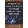 Endovenous Laser Treatment of Varicose Veins: Practical Technique